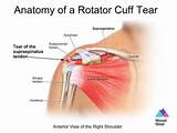 Rotator Cuff Pictures
