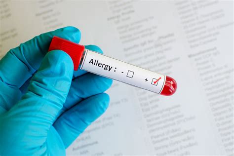 Are food sensitivity blood tests accurate? Rast Food Allergy Test - Lab 24