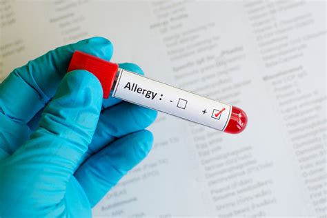This typically involves drawing blood from a vein in the arm and the results are not usually available for at least one week. Rast Food Allergy Test - Lab 24