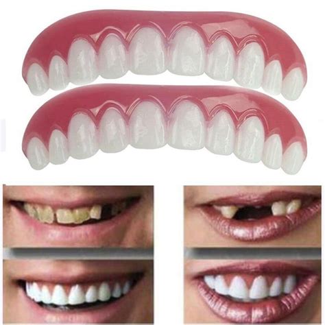 Top Bottom Veneers False Teeth Snap On Cosmetic Denture Perfect Smile