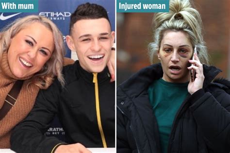 Phil Fodens Mum Claire 41 Caught In Alcohol Fuelled Brawl Which Left