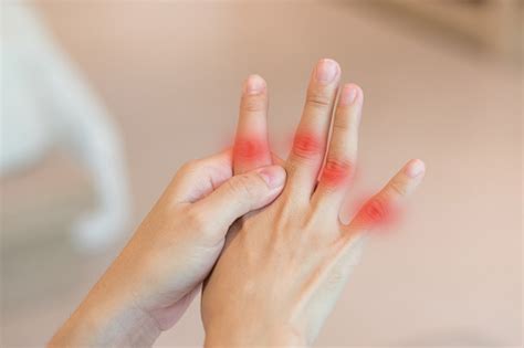 Overuse Hand Problems Woman Hand With Red Spot O Fingers As Suffer From