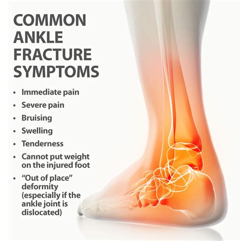 Fracture Broken Ankle Sprain