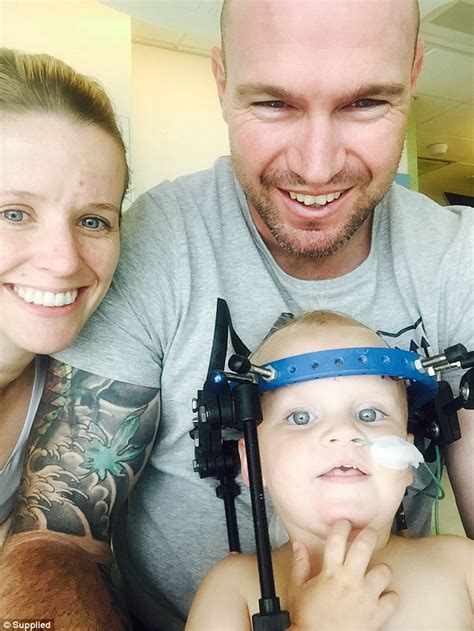 Dr Geoff Askin Says Baby Jaxon Taylor Is A Miracle After Spine