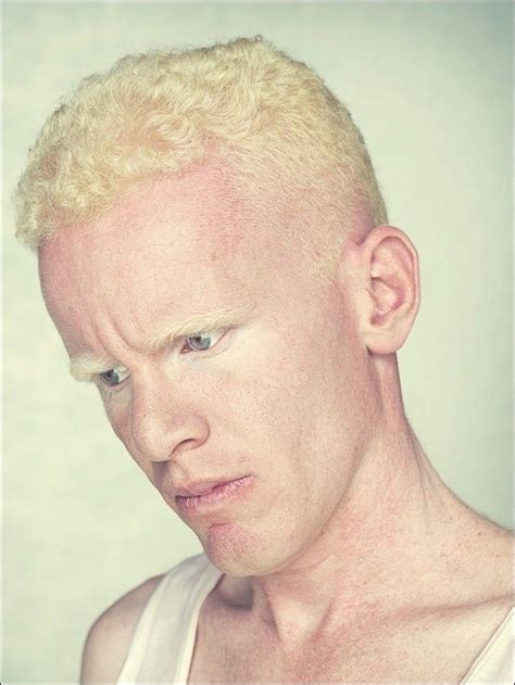 Albinos Project By Gustavo Lacerda Albino Human Albino Albino Model