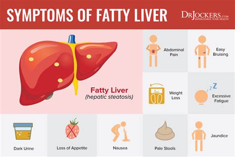 Jaundice (yellowing of the whites of the eyes and skin) nausea and vomiting. 12 Strategies to Heal Fatty Liver Naturally - DrJockers.com