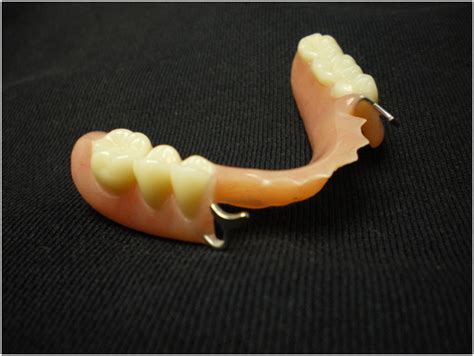 However, it isn't the best material for those with periodontal disease, because if you have gum disease, the shape of your mouth will change more, and you'll have to have your partial false tooth or teeth adjusted more often. Owings Mills Partial Dentures Pikesville Partial Denture ...