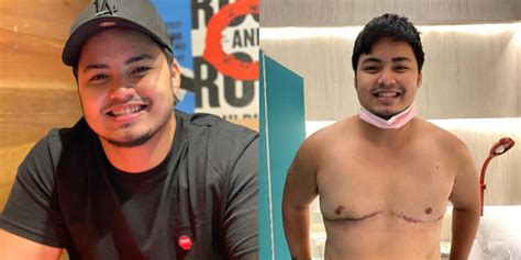 ex pbb housemate and transman jesi corcuera on having top surgery yan and simbolo ng aking