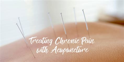 Treat Chronic Pain With Acupuncture Mph Blog