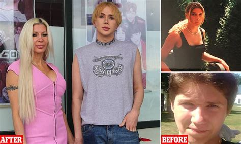 Couple Spend Over £250k On Cosmetic Surgery To Look Like Idols Daily