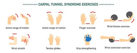 Carpal Tunnel Syndrome Stretches