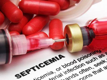 Septicemia Sintomas Causas E Tratamento