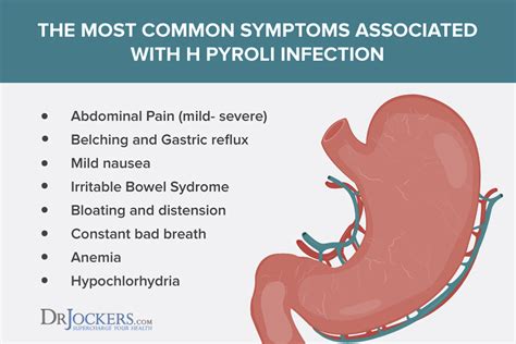 Treatment Of H Pylori Infection By Dr Radhika A Md Lybrate