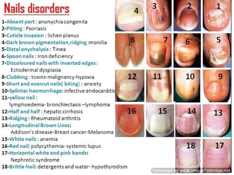 Nail Diseases And Disorders Chart Madduxdesign