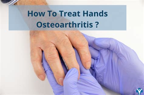 How To Treat Hand Osteoarthritis At Home Rheumatologist Oncall