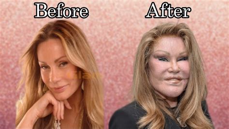 The Story Of Joselyn Wildenstein Aka Cat Woman Plastic Surgery