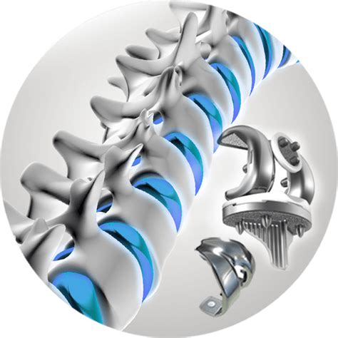 A large concentration of firms is in the product categories of disposables, surgical instruments and therapeutics. Home www.passionspine.com