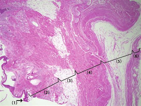 Histopathological Findings For He Staining From The Scalp To The