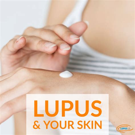 Living With Lupus How To Care For Your Skin Lupus La