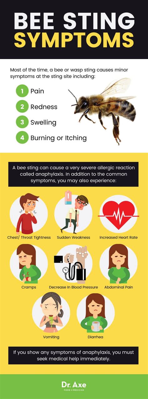 7 Home Remedies For Bee Stings Remedies For Bee Stings Bee Sting