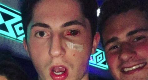 Find zach werenski stock photos in hd and millions of other editorial images in the shutterstock collection. Confirmed: Blue Jackets Rookie Zach Werenski's Injured Eye ...