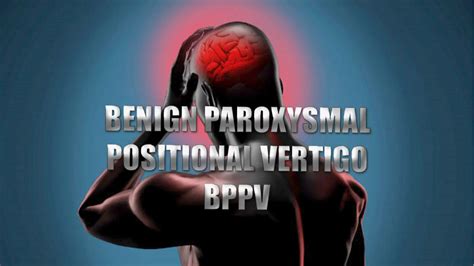 Benign Paroxysmal Positional Vertigo El Paso Tx Wellness Clinic