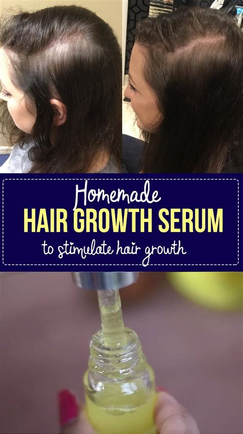 homemade diy hair growth serum to stimulate hair and stop hair fall healthy lifestyle