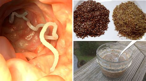 How To Get Rid Of Intestinal Parasites Recipe Youtube