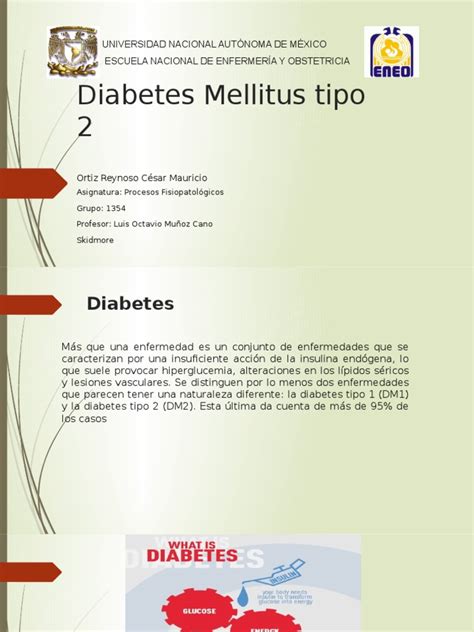 Diabetes Mellitus Tipo 2 Diabetes Mellitus Diabetes Mellitus Tipo 2