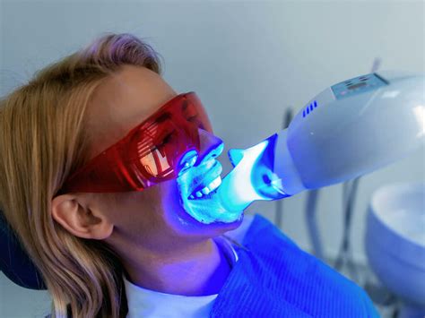Teeth Whitening Peoria Az Modern Dentistry Of Peoria