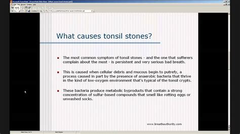 Tonsil stones, also known as tonsilloliths, are mineralizations of debris within the crevices of the tonsils. Tonsil Stones Causes - What Causes Tonsil Stones? - YouTube