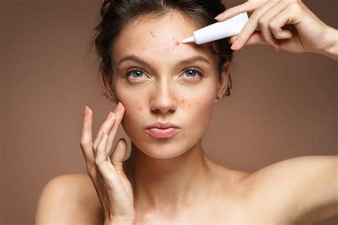 9 Common Myths About Chronic Acne Blog Balshi Dermatology