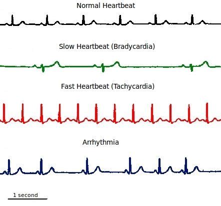 We did not find results for: Circulatory systems in animals | Transport systems in animals | Siyavula