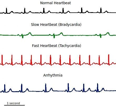 We did not find results for: Circulatory systems in animals | Transport systems in animals | Siyavula