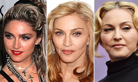 madonna what plastic surgeries did she had