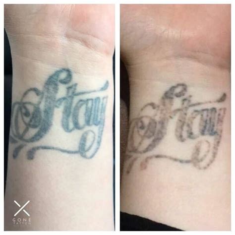 Before And After Of A Clients First Session Completely Healed You Can