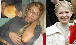 Yulia Tymoshenko Prison Pictures Show Former Ukrainian Pm And Orange