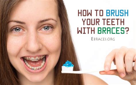 Tilt your toothbrush 45 degrees to clean the top and bottom of the braces. How to Brush Your Teeth with Braces Properly