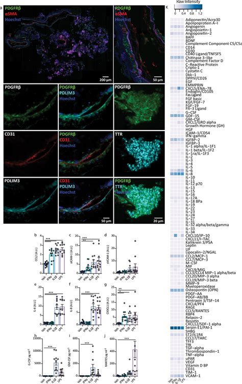 Characterisation Of Choroid Plexus Explant Cell Types And Inflammatory