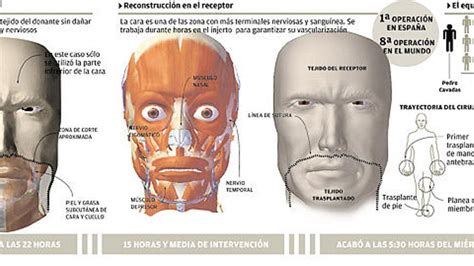 El Canario Al Que Se Le Trasplantó La Cara Tenía Cáncer La Provincia