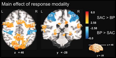 Involvement Of Human Left Dorsolateral Prefrontal Cortex In Perceptual