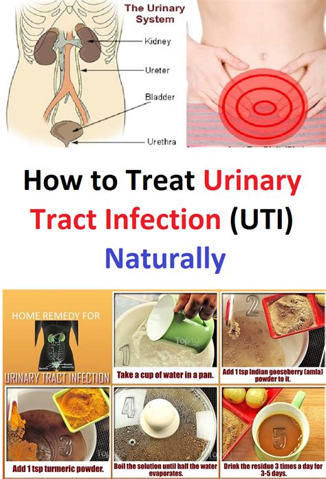 How To Treat Urinary Tract Infection Uti Naturally Urinary Tract