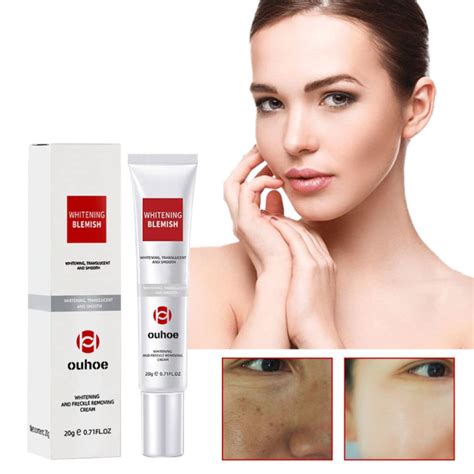 Effective Whitening Freckle Cream Remove Dark Spot Face Cream Removal