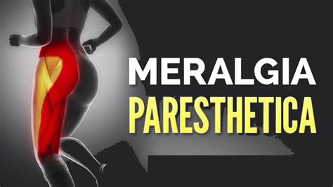 Meralgia Paresthetica Causes Symptoms Pain Relief And Treatment