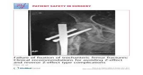 Failure Of Fixation Of Trochanteric Femur Fractures Clinical