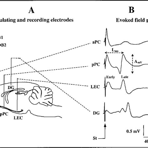 Schematic Representation Of The Implanted Electrodes And Recorded