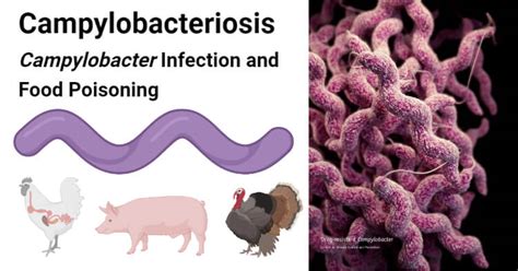 Campylobacteriosis Campylobacter Infection And Food Poisoning