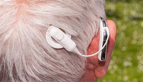 Cochlear Implants Mackay Hearing