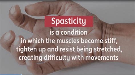 How To Reduce Spasticity In Hand Archives SAMARPAN PHYSIOTHERAPY 5632