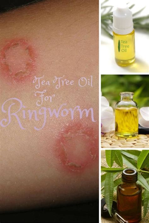Choose from three distinctive scents: How to Apply Tea Tree Oil for Ringworm